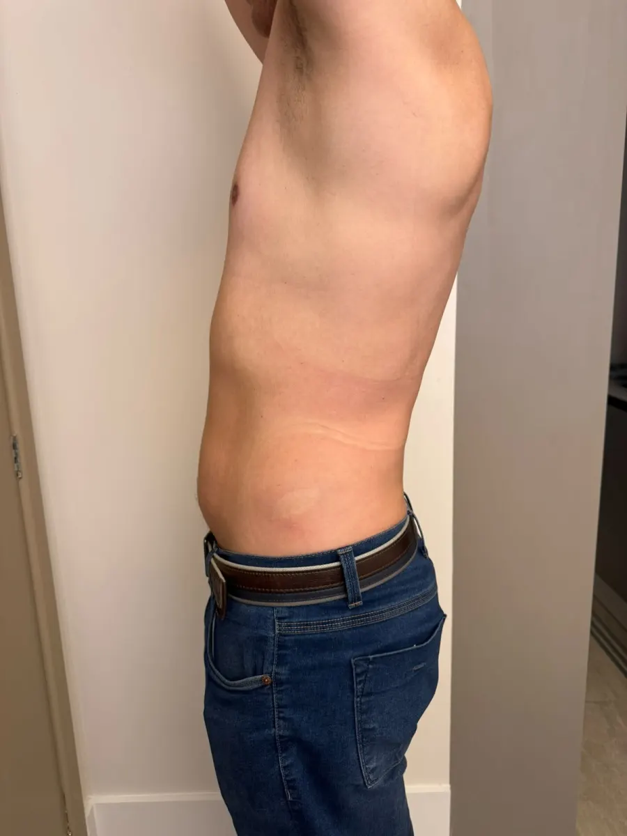 Depois - Caso Masculino